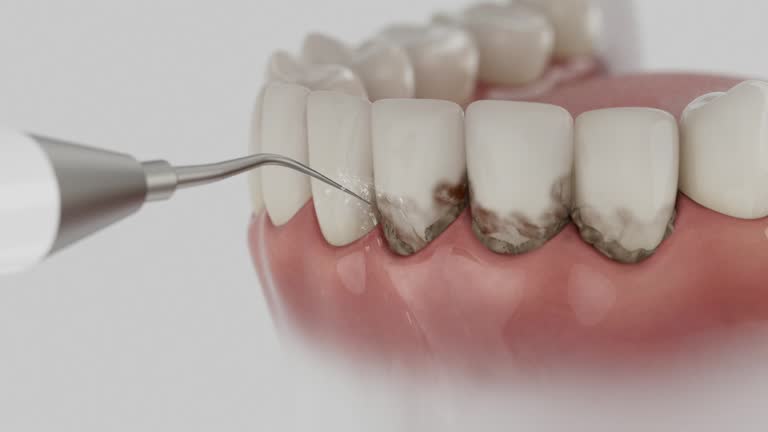 Reliable Dental Implants contractor in Rolesville, NC by Smile Center Dentistry